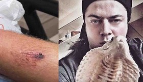 شعبده باز مشهور ایرانی از گزیده شدنش توسط مار کبرا گفت