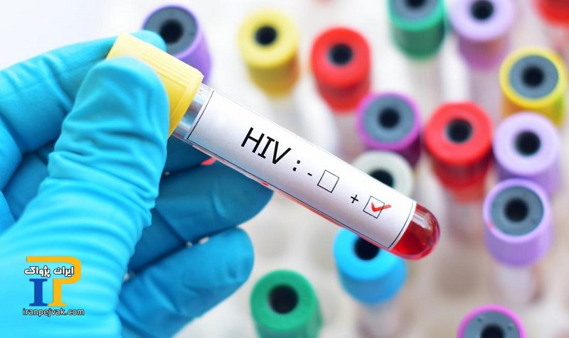 hiv