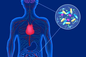 منشاء بیماری پارکینسون از روده ها است
