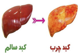 خواص بی‌نظیر این میوه برای کبد چرب