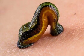 متخصصان طب سنتی: زالو درمانی هم خوب است، هم قانونی است / بیماران: هم هزینه فراوان دادیم، هم بیماری تشدید شد