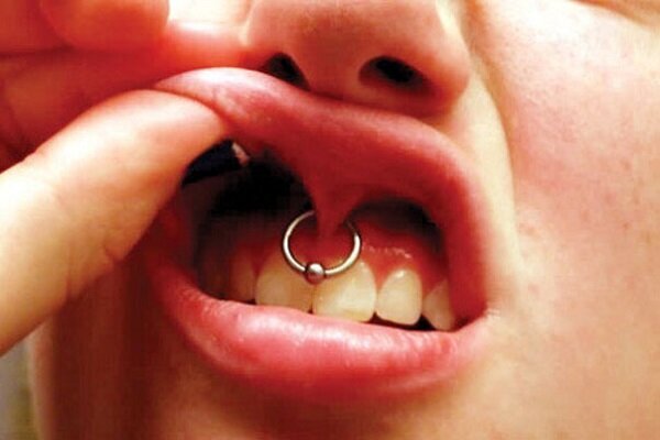 حلقههای مرگبار زیبایی!