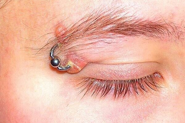 حلقههای مرگبار زیبایی!