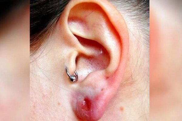 حلقههای مرگبار زیبایی!