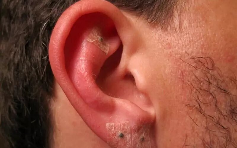 حلقههای مرگبار زیبایی!