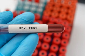 شیوع بالای HPV در تهران!