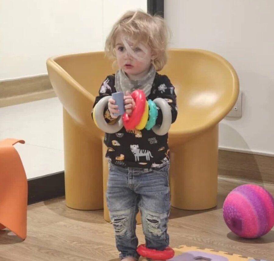 کودکان خردسال را نبوسید/ این کودک چشمش را از دست داد