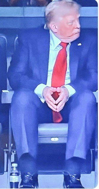 دلیل تورم پاهای ترامپ مشخص شد