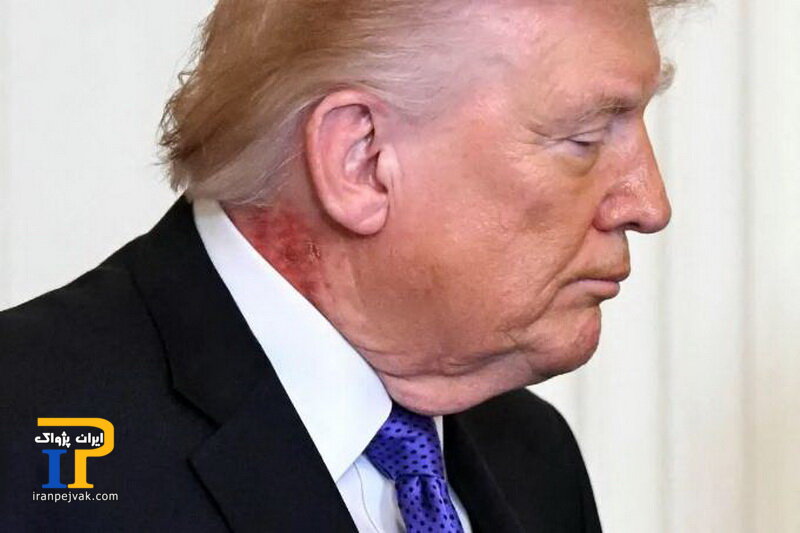 ترامپ